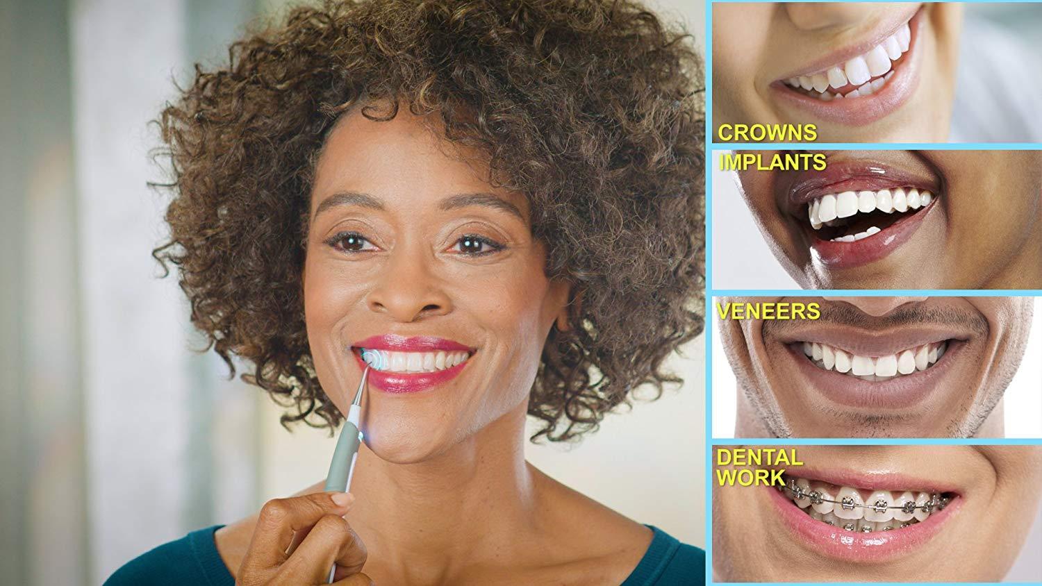 Ultrasonic Scalar Tooth Cleaner at Home Teeth Stain Remover Machine Teeth Whitening Ultrasonic Scalar Tooth Cleaner